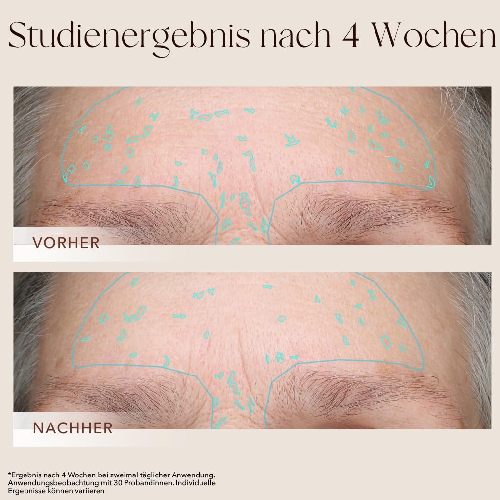 mellow-noir-seren-booster-brightening-serum-30-ml-flecken image 6