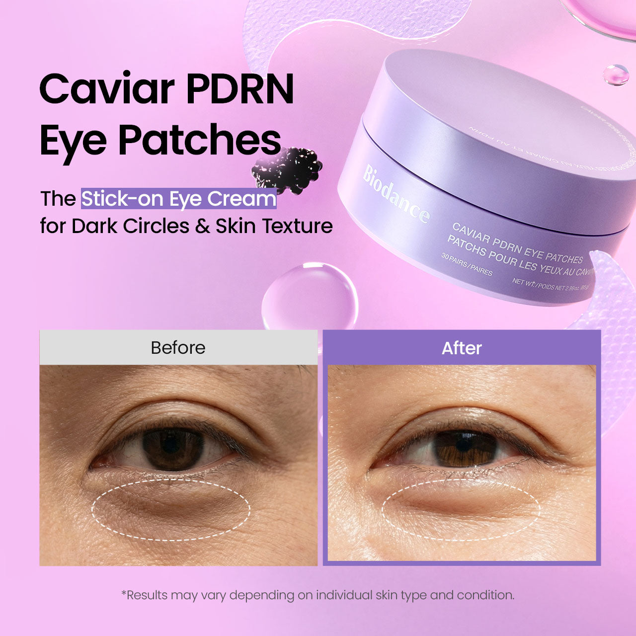 biodance-caviar-pdrn-augenpads-60-st-ck-straffende-augenpatches image 3