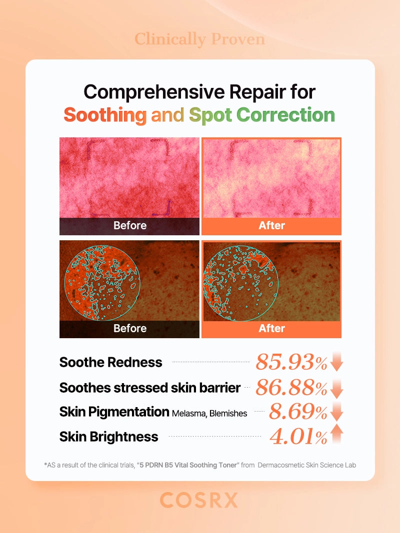cosrx-pdrn-5-b5-vital-soothing-toner-gesichtswasser-280-ml-beruhigend image 8