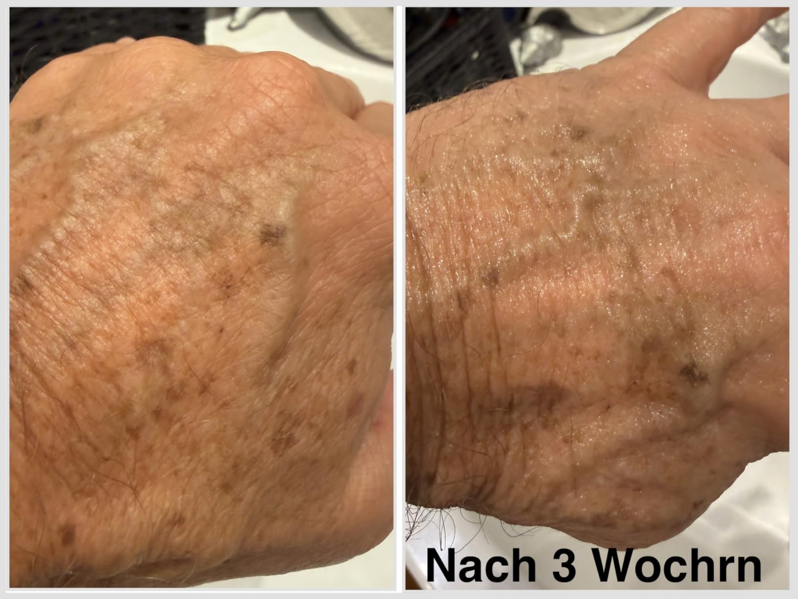 Dezente, sichtbare Verbesserung