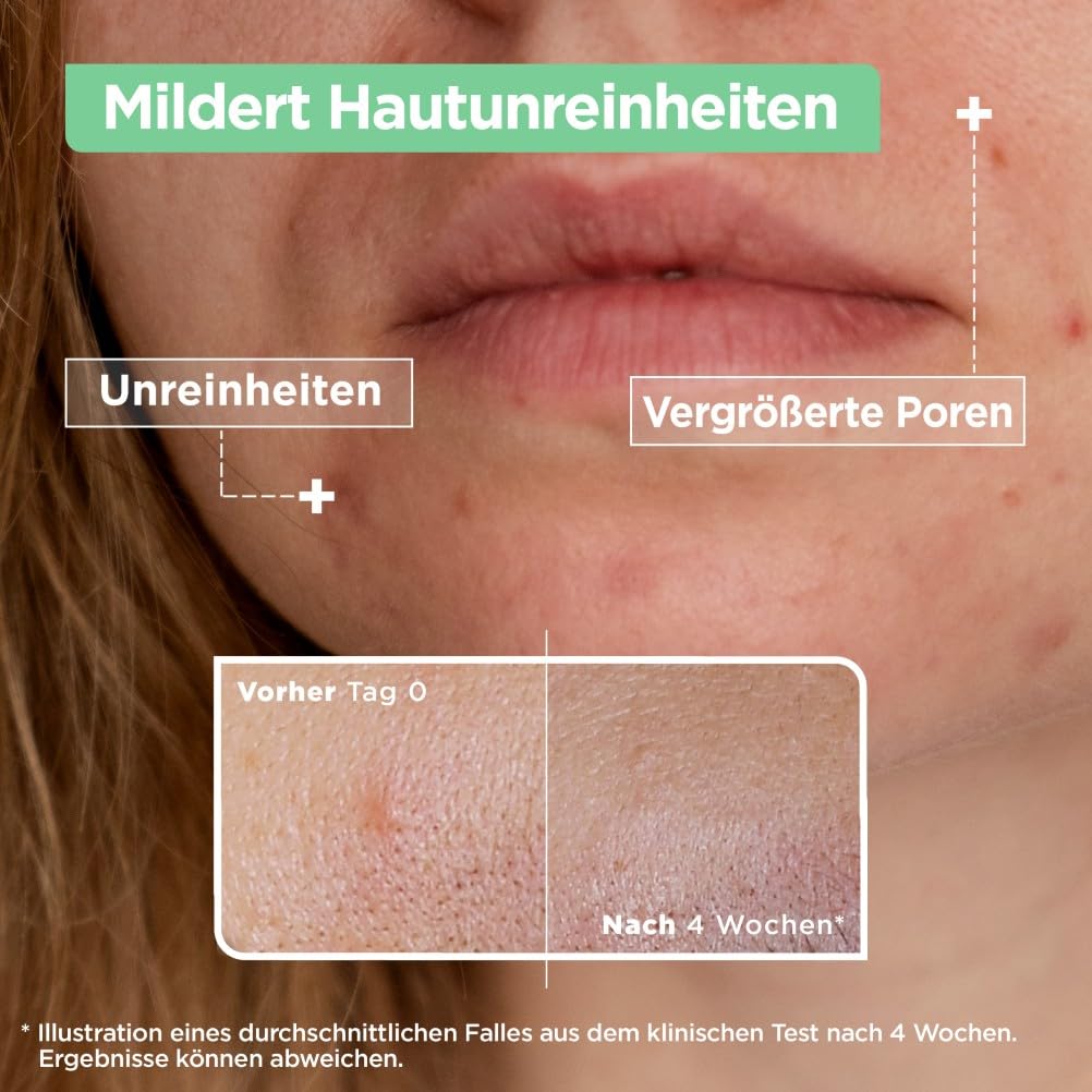 mixa-anti-unreinheiten-serum-30-ml-salicyls-ure-niacinamid image 3