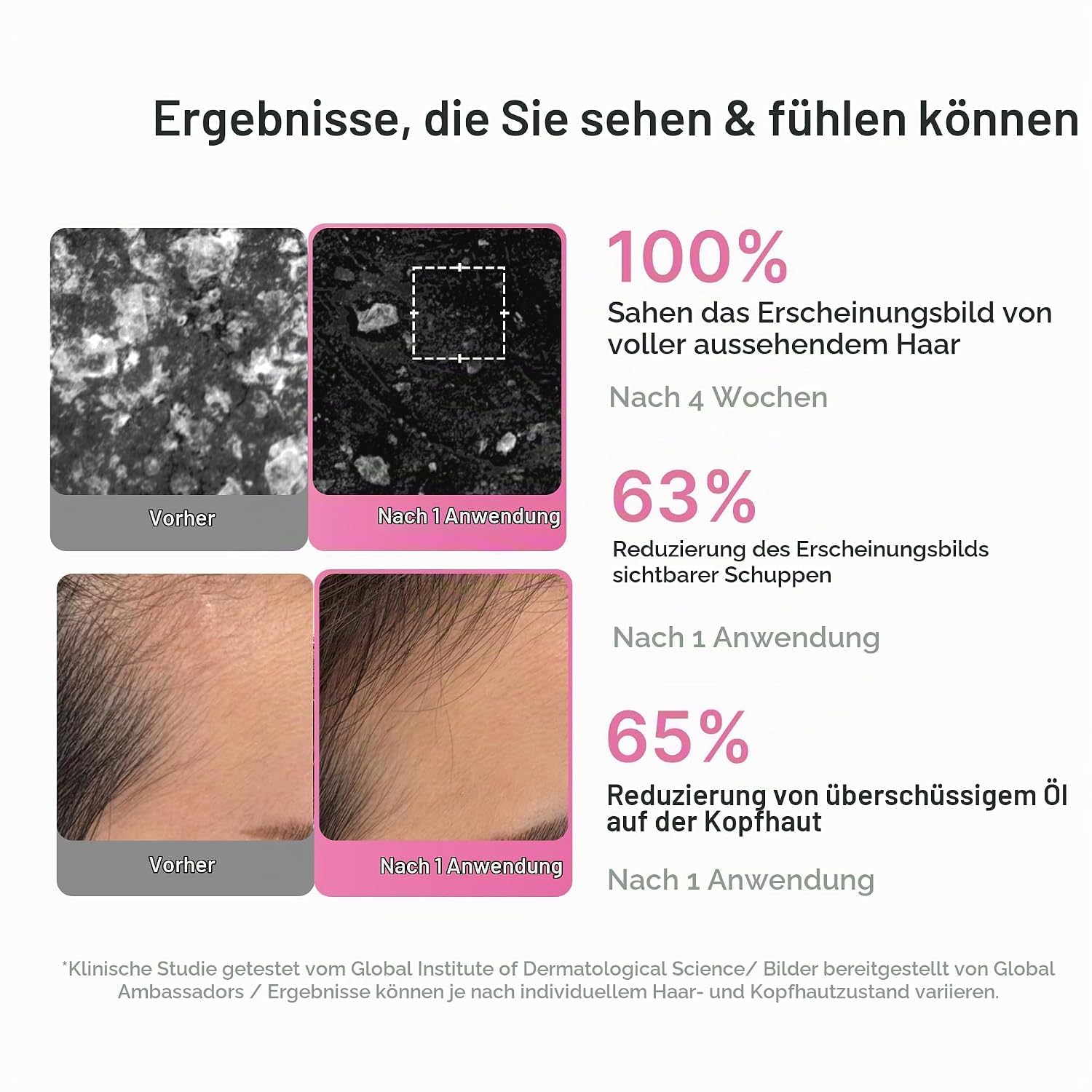medicube-pink-pdrn-rosemary-shampoo-400-ml-feines-haar image 5