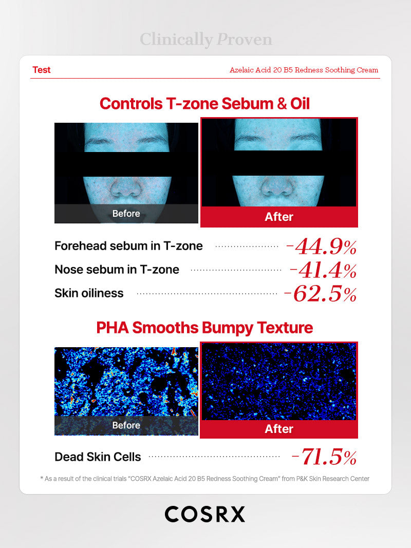 cosrx-azelaic-acid-20-b5-redness-creme-30-ml-gegen-r-tungen image 7