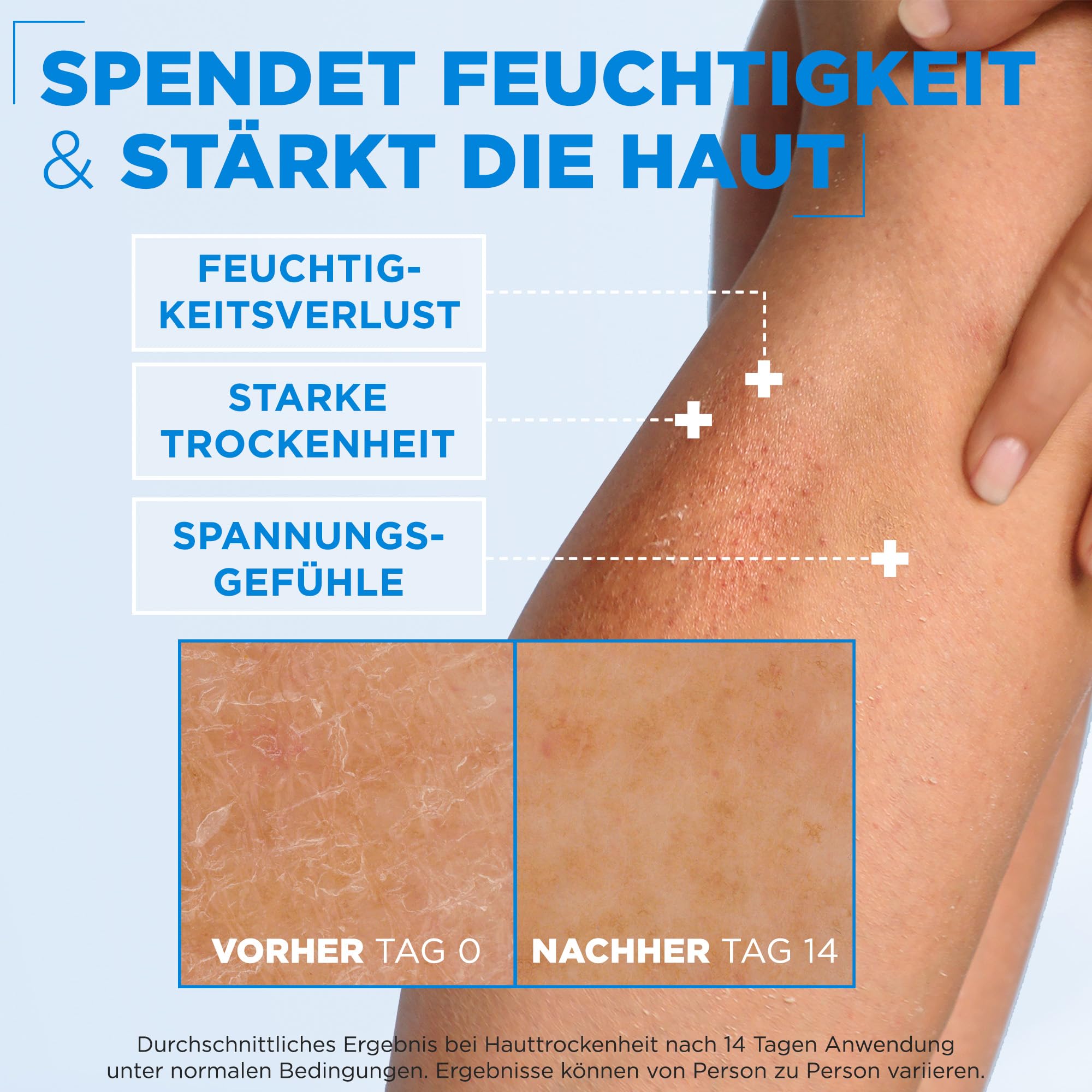 mixa-ceramide-protect-creme-400-ml-f-r-sehr-trockene-haut image 6