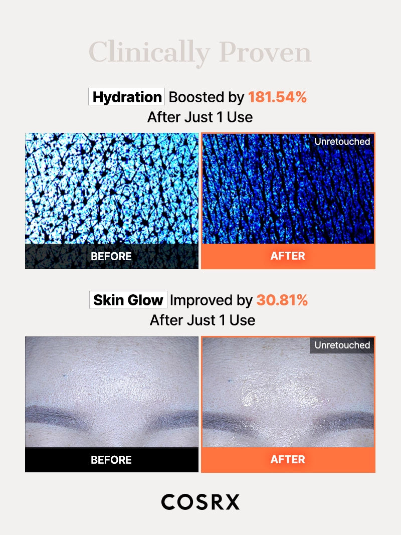 cosrx-5-pdrn-hyaluron-hydrogel-maske-1-st-ck-feucht image 6