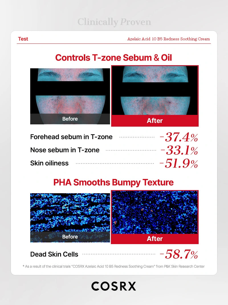 cosrx-azelaic-acid-10-b5-creme-r-tungen-30-ml-beruhigend image 7