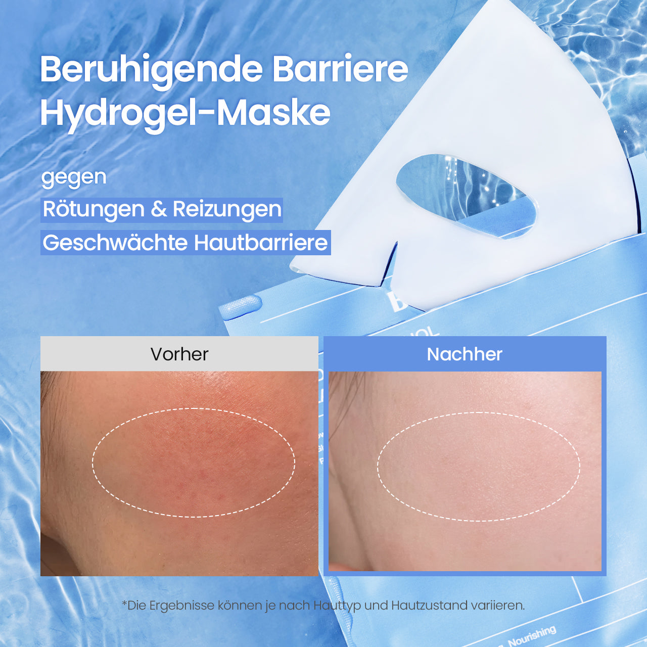 biodance-cera-nol-hydrogel-gesichtsmaske-k-hlend image 4