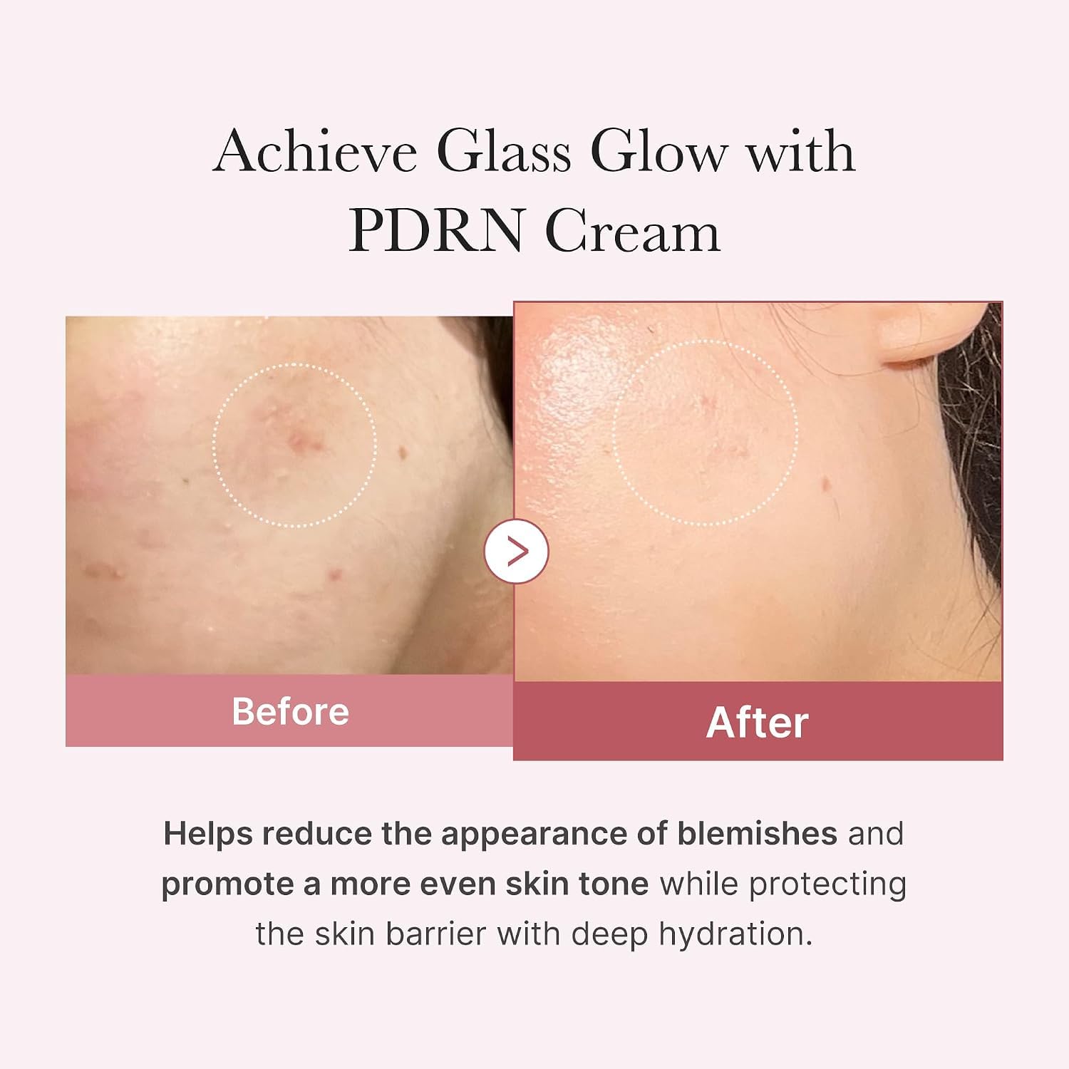 medicube-pdrn-pink-hyaluron-feuchtigkeitscreme-50-ml-glass-skin image 3