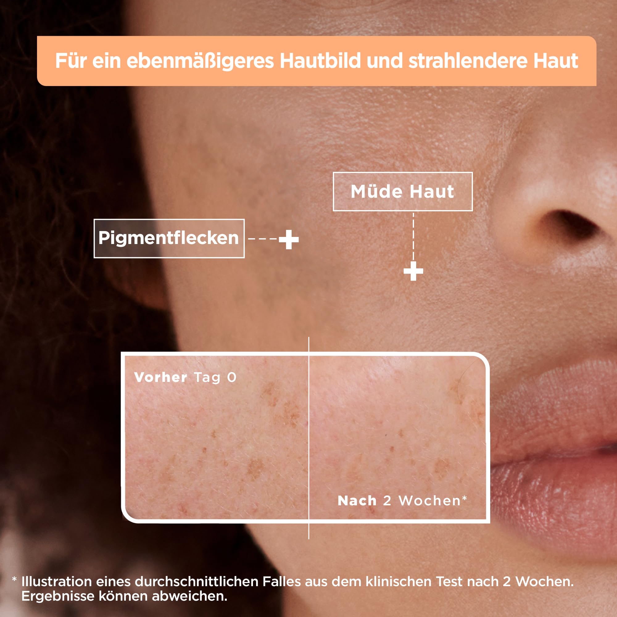 mixa-visage-anti-pigmentflecken-serum-vitamin-c-niacinamid-lsf-20-30-ml image 6