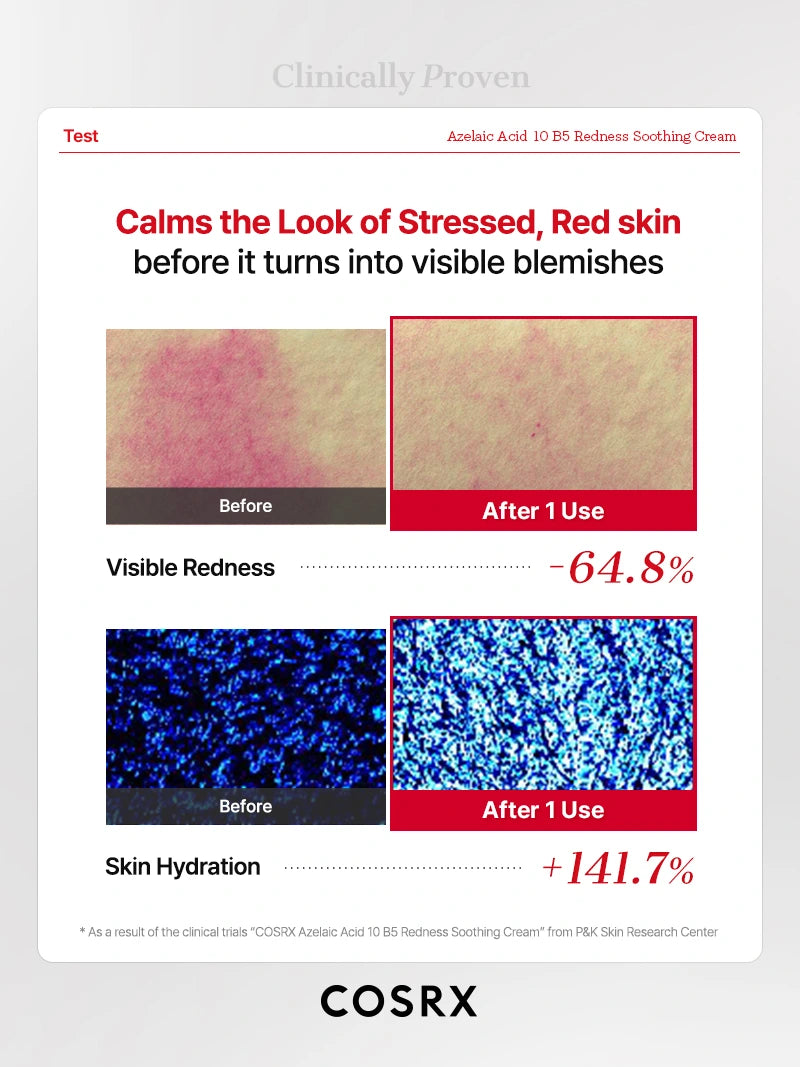 cosrx-azelaic-acid-10-b5-creme-r-tungen-30-ml-beruhigend image 8