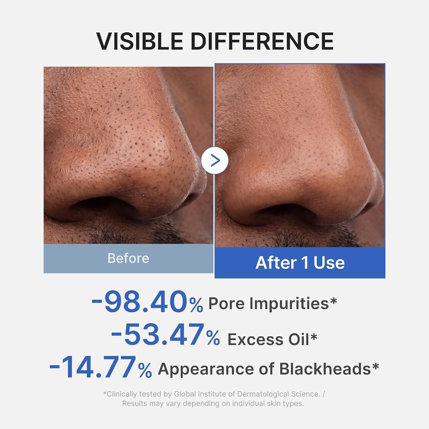 medicube-zero-pore-blackhead-mud-maske-tonerde-mitesser image 4