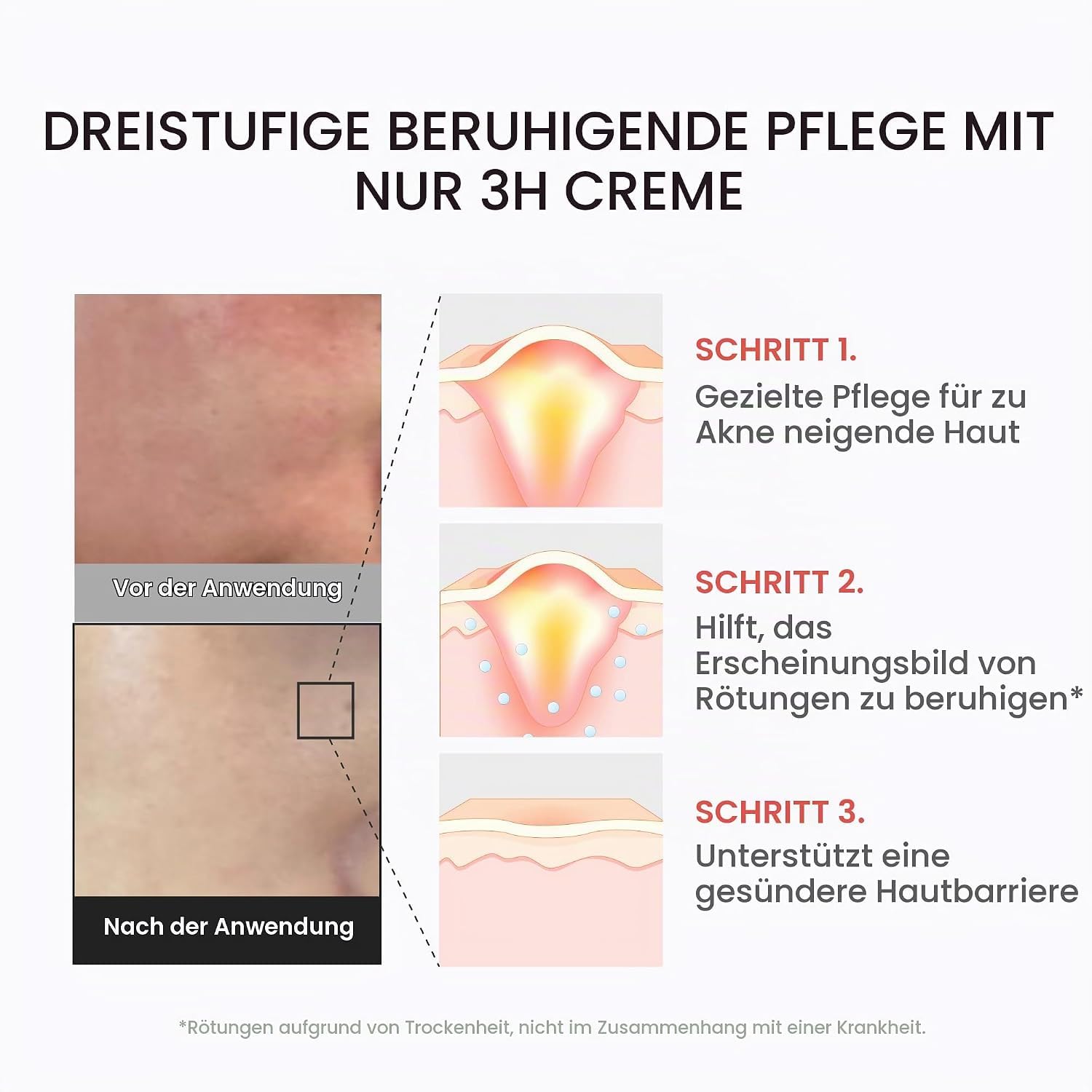 medicube-red-3h-daily-relief-creme-f-r-alle-hauttypen-spot-care image 4