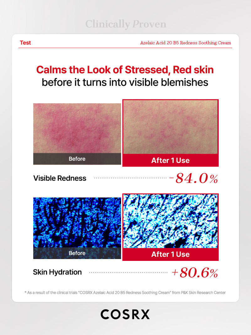 cosrx-azelaic-acid-20-b5-redness-creme-30-ml-gegen-r-tungen image 8
