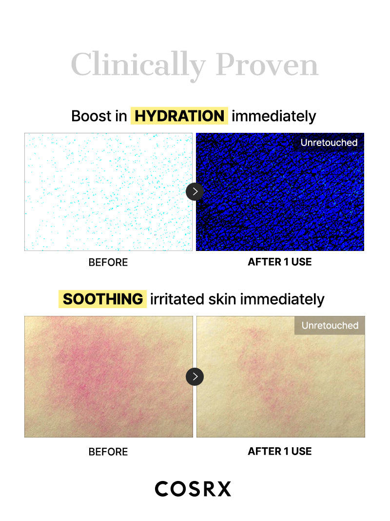 cosrx-snail-mucin-glass-glow-hydrogel-maske-3-st-ck-glow image 7