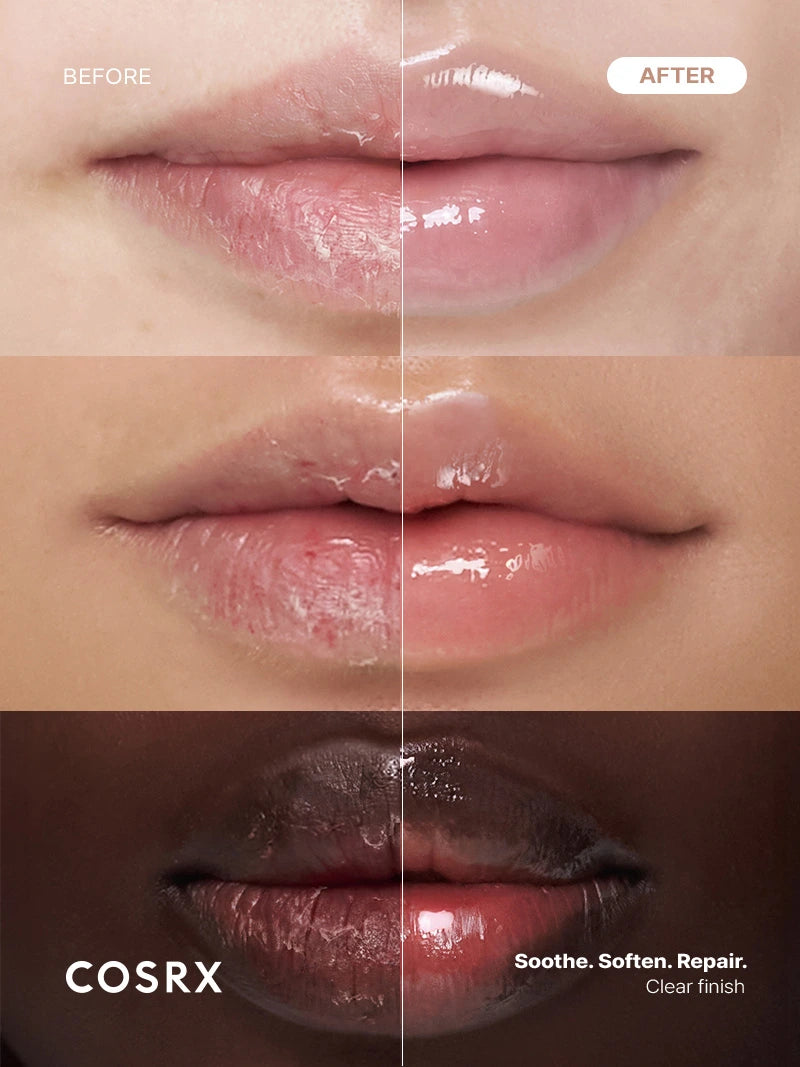 cosrx-5-peptide-b5-lip-balm-repair-salve-12g-sensible-lippen image 3