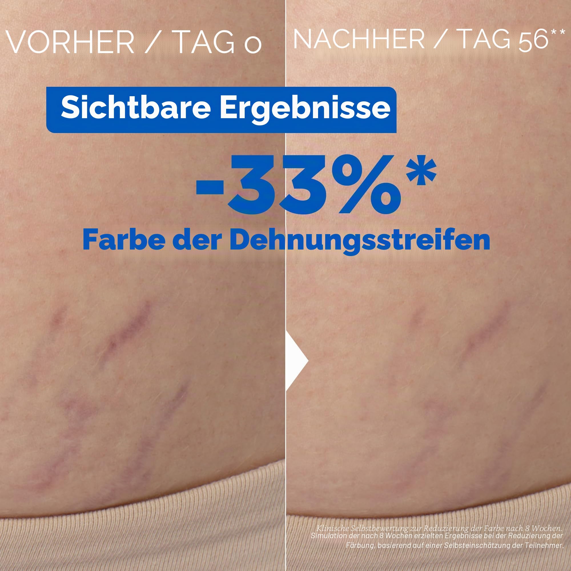 mixa-corps-k-rper-l-gegen-dehnungsstreifen-30-omega-6-9-100-ml image 4