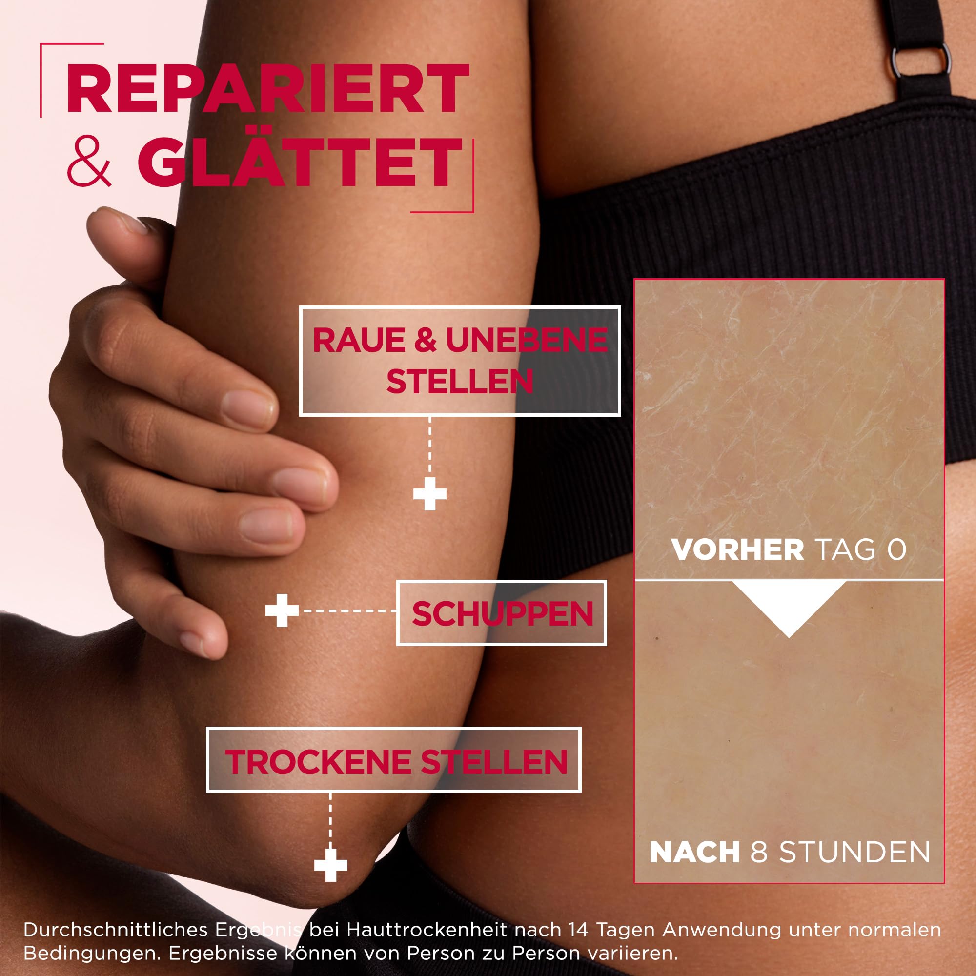 mixa-corps-urea-cica-repair-bodylotion-400-ml-trockene-haut image 5