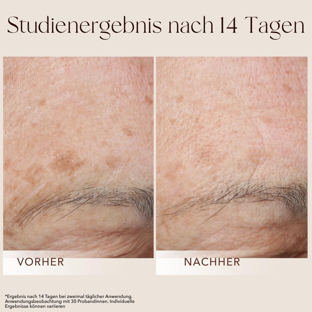 mellow-noir-seren-booster-brightening-serum-30-ml-flecken image 5