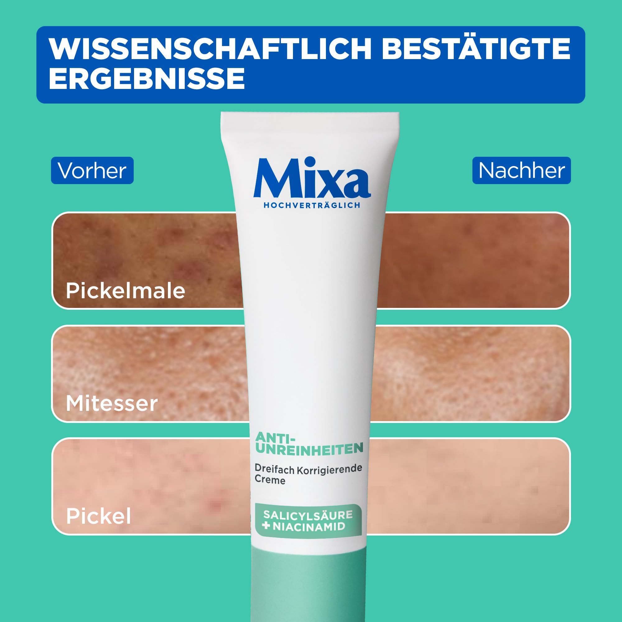 mixa-visage-anti-unreinheiten-gesichtscreme-40-ml-mit-salicyls-ure image 3