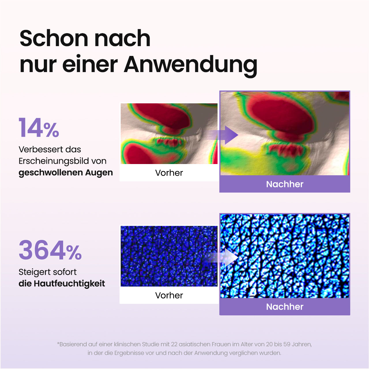 biodance-caviar-pdrn-augenpads-hydrogel-f-r-empfindliche-haut image 3